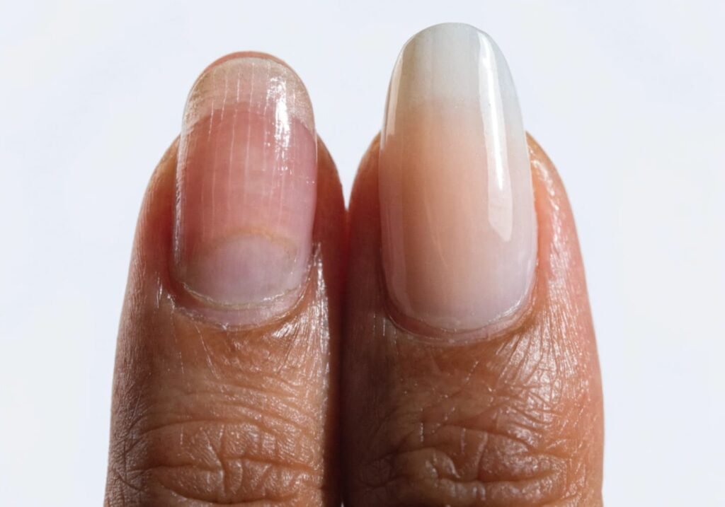 Comparison of natural nail versus acrylic extension nail shape and length.